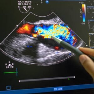Certificate Course in color Doppler ultrasound - CCDU